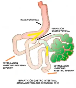 BT SG Biparticion BT SG Biparticion