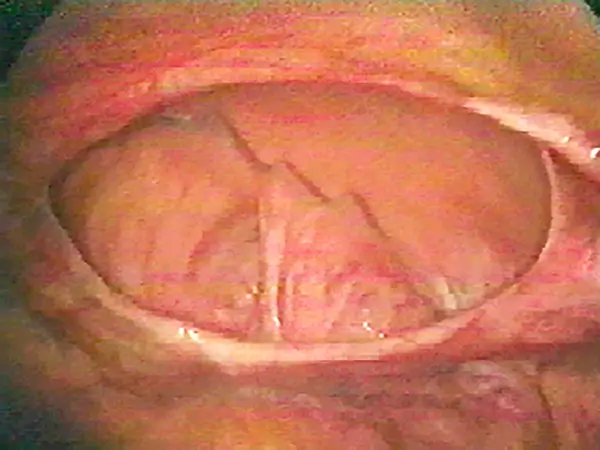 Eventracion-2